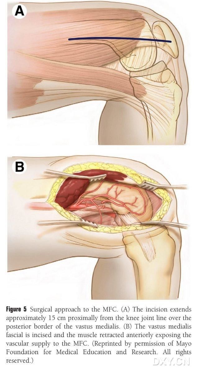 letsoho5